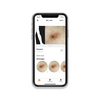 HEINE DERM App Patients on Smartphone